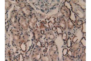 IHC-P analysis of Human Kidney Tissue, with DAB staining. (PLA2G4A anticorps  (AA 563-749))