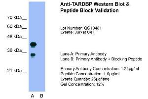 Host:  Rabbit  Target Name:  TARDBP  Sample Type:  Jurkat  Lane A:  Primary Antibody  Lane B:  Primary Antibody + Blocking Peptide  Primary Antibody Concentration:  1. (TARDBP anticorps  (C-Term))
