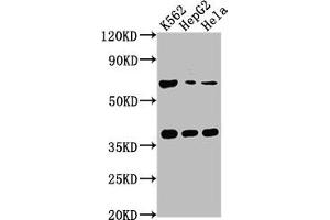 Western Blot Positive WB detected in: K562 whole cell lysate, HepG2 whole cell lysate, Hela whole cell lysate All lanes: CFHR5 antibody at 1:1000 Secondary Goat polyclonal to rabbit IgG at 1/50000 dilution Predicted band size: 65 kDa Observed band size: 65 kDa
