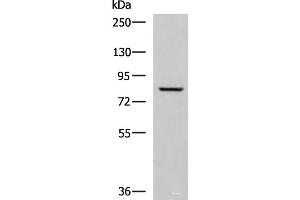 Western blot analysis of Human tongue tissue lysate using TGM3 Polyclonal Antibody at dilution of 1:800 (TGM3 anticorps)