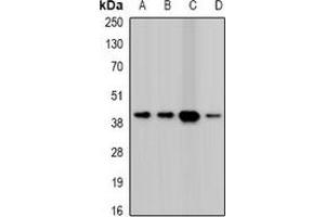 Western blot analysis of Twinfilin-2 expression in HepG2 (A), A431 (B), mouse heart (C), mouse spleen (D) whole cell lysates. (TWF2 anticorps)