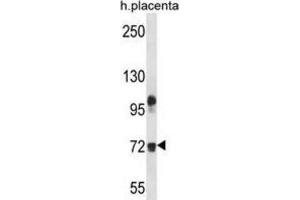 Western Blotting (WB) image for anti-Fibulin 1 (FBLN1) antibody (ABIN2998151) (Fibulin 1 anticorps)