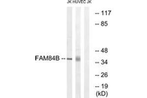Western blot analysis of extracts from Jurkat/HuvEc cells, using FAM84B Antibody. (FAM84B anticorps  (AA 11-60))