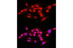 Immunofluorescence analysis of U2OS cells using NFKB1 Rabbit pAb (ABIN6130581, ABIN6144571, ABIN6144573 and ABIN7101802) at dilution of 1:50 (40x lens). (NFKB1 anticorps  (AA 740-964))