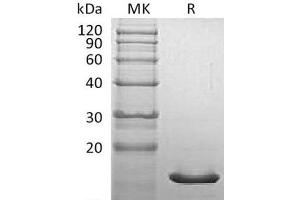 Western Blotting (WB) image for Synuclein, alpha (SNCA) protein (ABIN7320688) (SNCA Protéine)
