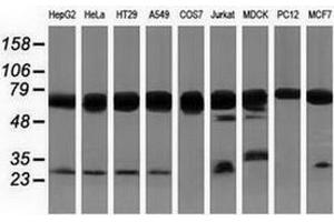 Western blot analysis of extracts (35 µg) from 9 different cell lines by using anti-PUS7 monoclonal antibody. (PUS7 anticorps)