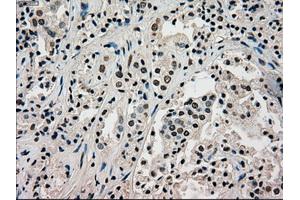 Image no. 9 for anti-Premelanosome Protein (PMEL) antibody (ABIN1500300)