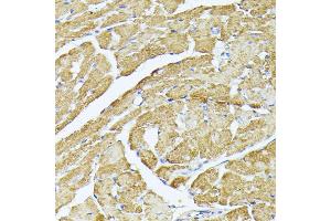 Immunohistochemistry of paraffin-embedded mouse heart using MT-CO3 antibody (ABIN7266636) at dilution of 1:100 (40x lens). (COX3 anticorps)