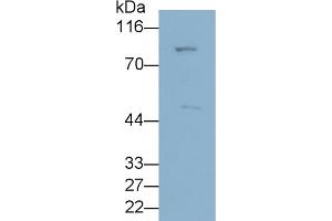 Detection of ANGPTL3 in HepG2 cell lysate using Polyclonal Antibody to Angiopoietin Like Protein 3 (ANGPTL3) (ANGPTL3 anticorps  (AA 22-281))