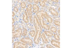 Immunohistochemistry of paraffin-embedded mouse kidney using GFPT1 Rabbit mAb (ABIN7267430) at dilution of 1:150 (40x lens). (GFPT1 anticorps)
