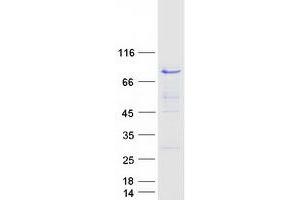 Validation with Western Blot