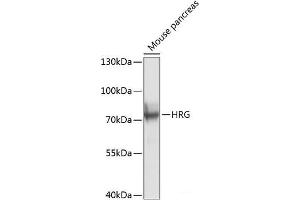 Western blot analysis of extracts of Mouse pancreas using HRG Polyclonal Antibody at dilution of 1:1000. (HRG anticorps)