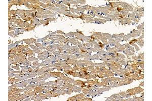 ABIN6256935 and ABIN6274838 at 1/100 staining rat heart tissue by IHC-P. (Amphiphysin anticorps  (Internal Region))