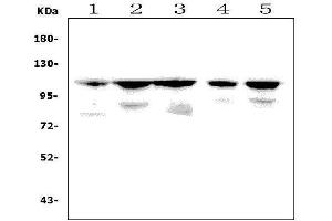 Western blot analysis of PPARGC1B using anti-PPARGC1B antibody (ABIN7602488).