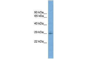WB Suggested Anti-TMEM139 Antibody Titration: 0. (TMEM139 anticorps  (N-Term))