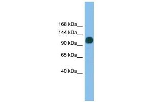 USP36 antibody used at 1 ug/ml to detect target protein. (USP36 anticorps  (N-Term))