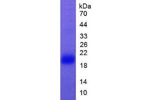SDS-PAGE of Protein Standard from the Kit (Highly purified E. (FAS Kit CLIA)