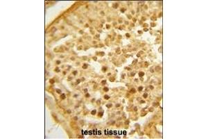 Formalin-fixed and paraffin-embedded human testis tissue reacted with BAHD1 Antibody (C-term), which was peroxidase-conjugated to the secondary antibody, followed by DAB staining.