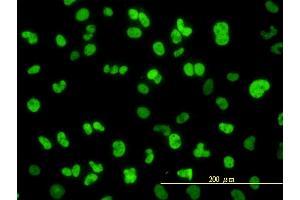 Immunofluorescence of monoclonal antibody to NFIC on HeLa cell. (NFIC anticorps  (AA 1-428))