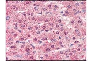 Immunohistochemistry (IHC) image for anti-Cathepsin L1 (CTSL1) (AA 114-333) antibody (ABIN317508) (Cathepsin L anticorps  (AA 114-333))