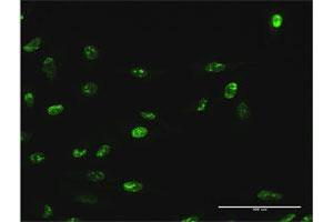 Immunofluorescence of purified MaxPab antibody to WDR18 on HeLa cell.