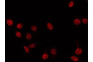 ABIN6266856 staining 293 by IF/ICC. (IRX2 anticorps  (Internal Region))