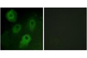 Immunofluorescence analysis of HeLa cells, using PKC delta (Ab-52) Antibody. (PKC delta anticorps  (AA 18-67))