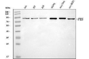 Western blot analysis of FES using anti-FES antibody (ABIN7599948).
