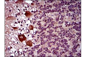 Immunohistochemical analysis of paraffin-embedded cerebellum tissues using DNM1L mouse mAb with DAB staining.
