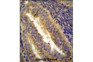 JUN Antibody immunohistochemistry analysis in formalin fixed and paraffin embedded human uterus tissue followed by peroxidase conjugation of the secondary antibody and DAB staining. (C-JUN anticorps  (C-Term))