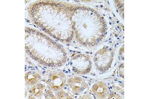 Immunohistochemistry of paraffin-embedded human stomach using CPM antibody (ABIN5975037) at dilution of 1/100 (40x lens). (CPM anticorps)