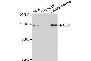 Immunoprecipitation analysis of 150ug extracts of MCF7 cells using 3ug RAD50 antibody.
