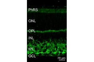Indirect immunostaining of a PFA fixed mouse retina section (dilution 1 : 5000).