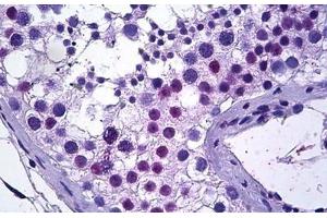 Human Testis: Formalin-Fixed, Paraffin-Embedded (FFPE) (TSPY-Like 2 anticorps  (AA 680-693))