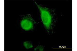 Immunofluorescence of purified MaxPab antibody to EPCAM on HeLa cell.