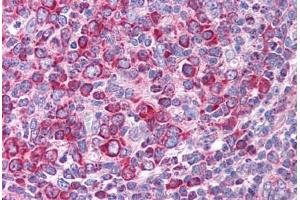 Human Tonsil (formalin-fixed, paraffin-embedded) stained with LEF1 antibody ABIN214792 at 5 ug/ml followed by biotinylated goat anti-rabbit IgG secondary antibody ABIN481713, alkaline phosphatase-streptavidin and chromogen.