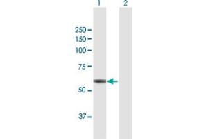 Western Blot analysis of ST7 expression in transfected 293T cell line by ST7 MaxPab polyclonal antibody.