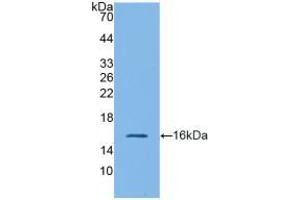 Western blot analysis of recombinant Mouse GLP1R. (GLP1R anticorps  (AA 25-145))