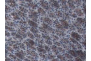 Detection of AGT in Rat Stomach Tissue using Monoclonal Antibody to Angiotensinogen (AGT) (AGT anticorps  (AA 25-477))