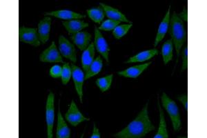 MCF7 cells were fixed with paraformaldehyde, permeabilized with 0.