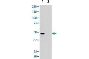 Western blot analysis of pre-incubated with (2) and without (1) blocking peptide in 293 cell lysate with MAGEA11 polyclonal antibody .