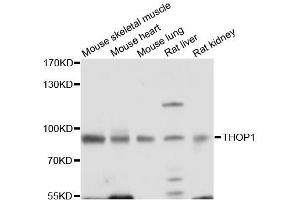 Western blot analysis of extracts of various cell lines, using THOP1 antibody (ABIN5996210) at 1/1000 dilution. (Thimet Oligopeptidase 1 anticorps)