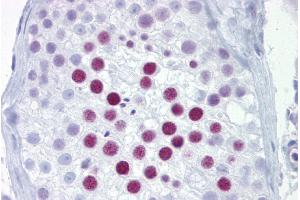 anti-Paired-Like Homeobox 2a (PHOX2A) (N-Term) antibody