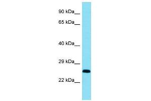 Host:  Rabbit  Target Name:  Bcl11a  Sample Type:  Mouse Heart lysates  Antibody Dilution:  1. (BCL11A anticorps  (C-Term))