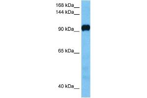Host:  Mouse  Target Name:  ATP2A3  Sample Tissue:  Mouse Liver  Antibody Dilution:  1ug/ml (ATP2A2 anticorps  (C-Term))