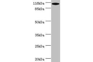 Western blot All lanes: MYO19 antibody at 2 μg/mL + A549 whole cell lysate Secondary Goat polyclonal to rabbit IgG at 1/10000 dilution Predicted band size: 110, 36, 72, 87 kDa Observed band size: 110 kDa (Myosin XIX anticorps  (AA 2-770))