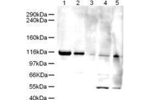 Western blot using  Affinity Purified anti-Elg1 antibody shows detection of a band ~120 kDa corresponding to human Elg1 (arrowhead) in various cell lysates. (ATAD5 anticorps  (AA 63-76))