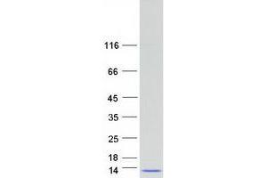 SRA Stem-Loop Interacting RNA Binding Protein (SLIRP) protein (Myc-DYKDDDDK Tag)