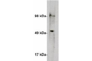 Image no. 2 for anti-serine Palmitoyltransferase, Long Chain Base Subunit 1 (SPTLC1) antibody (ABIN4620353) (SPTLC1 anticorps)