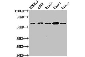 Western Blot Positive WB detected in: HEK293 whole cell lysate, A549 whole cell lysate, Mouse brain tissue, Mouse heart tissue, Rat brain tissue All lanes: PXK antibody at 2. (PXK anticorps  (AA 1-200))